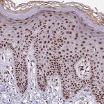 Merck Anti-THOC2 antibody produced in rabbit