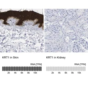 Merck Anti-KRT1 antibody produced in rabbit