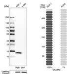 Merck Anti-CRABP2 antibody produced in rabbit