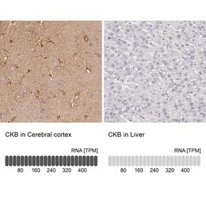 Merck Anti-CKB antibody produced in rabbit