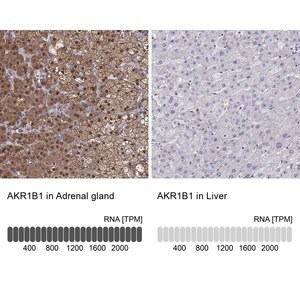 Merck Anti-AKR1B1 antibody produced in rabbit
