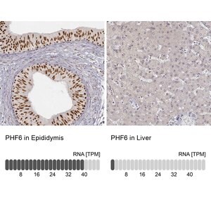 Merck Anti-PHF6 antibody produced in rabbit