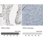Merck Anti-TPX2 antibody produced in rabbit