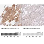 Merck Anti-CACNA1S antibody produced in rabbit