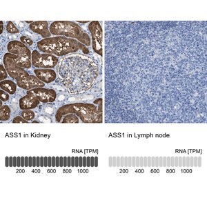 Merck Anti-ASS1 antibody produced in rabbit
