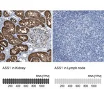 Merck Anti-ASS1 antibody produced in rabbit