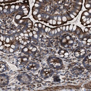 Merck Anti-AGPAT2 antibody produced in rabbit