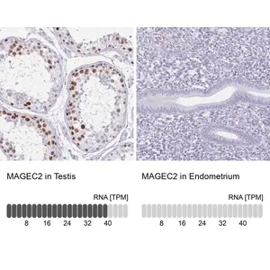 Merck Anti-MAGEC2 antibody produced in rabbit