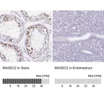 Merck Anti-MAGEC2 antibody produced in rabbit