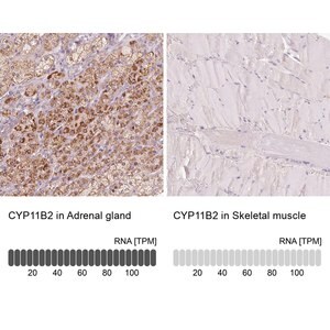 Merck Anti-CYP11B2 antibody produced in rabbit