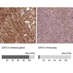 Merck Anti-SAT2 antibody produced in rabbit