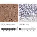 Merck Anti-TECPR2 antibody produced in rabbit