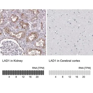 Merck Anti-LAD1 antibody produced in rabbit