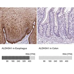 Merck Anti-ALDH3A1 antibody produced in rabbit