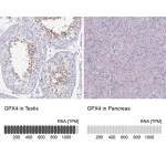 Merck Anti-GPX4 antibody produced in rabbit