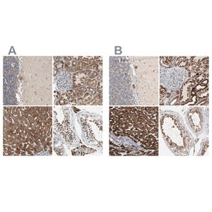 Merck Anti-ACAT1 antibody produced in rabbit