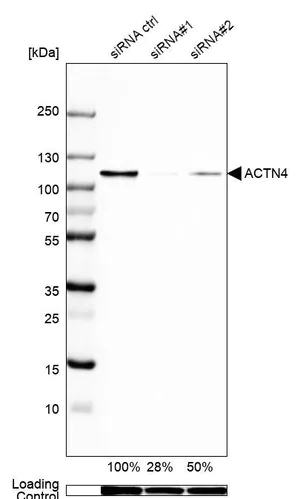 Merck Anti-ACTN4 antibody produced in rabbit