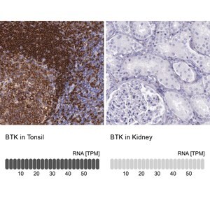 Merck Anti-BTK antibody produced in rabbit
