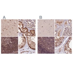 Merck Anti-NSFL1C antibody produced in rabbit