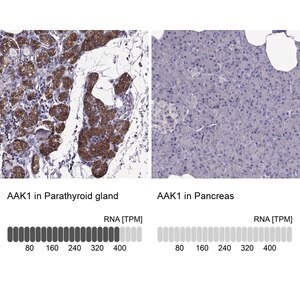 Merck Anti-AAK1 antibody produced in rabbit