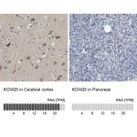 Merck Anti-KCNQ5 antibody produced in rabbit