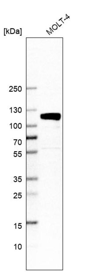 Merck Anti-QRICH1 antibody produced in rabbit