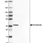Merck Anti-RNASEH2B antibody produced in rabbit