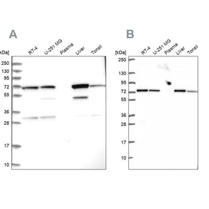 Merck Anti-SDHA antibody produced in rabbit