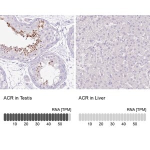 Merck Anti-ACR antibody produced in rabbit