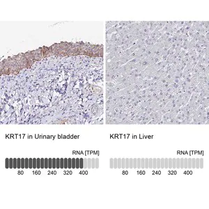 Merck Anti-KRT17 antibody produced in rabbit