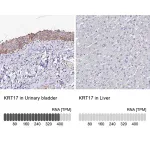 Merck Anti-KRT17 antibody produced in rabbit