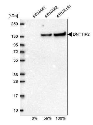 Merck Anti-DNTTIP2 antibody produced in rabbit