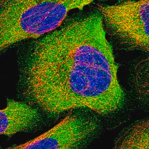 Merck Anti-IL13 antibody produced in rabbit