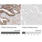 Merck Anti-TPCN2 antibody produced in rabbit