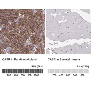 Merck Anti-CASR antibody produced in rabbit