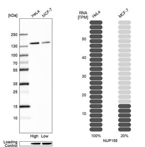 Merck Anti-NUP155 antibody produced in rabbit