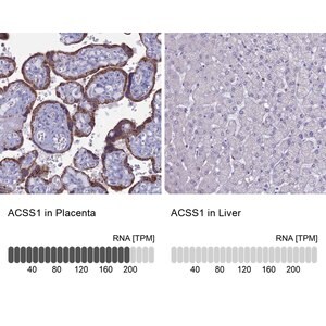 Merck Anti-ACSS1 antibody produced in rabbit