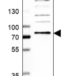 Merck Anti-UBQLN2 antibody produced in rabbit