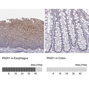 Merck Anti-PADI1 antibody produced in rabbit