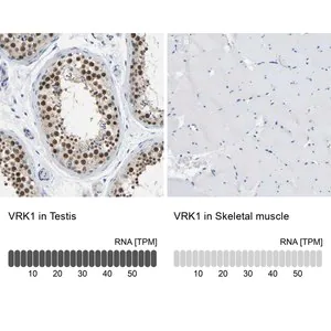 Merck Anti-VRK1 antibody produced in rabbit