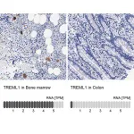 Merck Anti-TREML1 antibody produced in rabbit