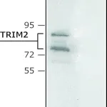 Merck Anti-TRIM2 antibody produced in rabbit