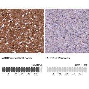 Merck Anti-ADD2 antibody produced in rabbit