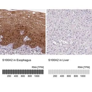 Merck Anti-S100A2 antibody produced in rabbit
