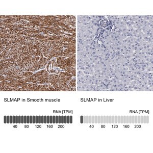 Merck Anti-SLMAP antibody produced in rabbit