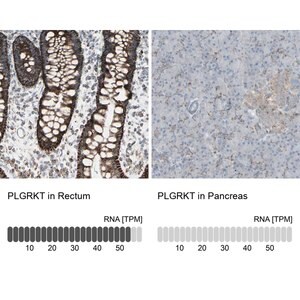 Merck Anti-PLGRKT antibody produced in rabbit