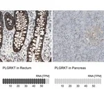 Merck Anti-PLGRKT antibody produced in rabbit