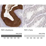 Merck ANTI-PNP antibody produced in rabbit
