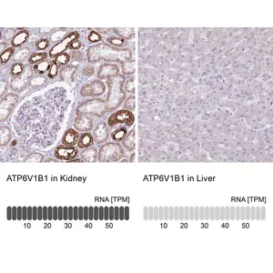 Merck Anti-ATP6V1B1 antibody produced in rabbit