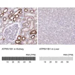 Merck Anti-ATP6V1B1 antibody produced in rabbit